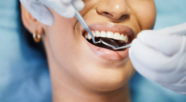Best Broken or Cracked Tooth Emergency Dentist in Canastota, NY