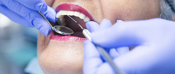 Best Emergency Dental Extractions in Canastota, NY